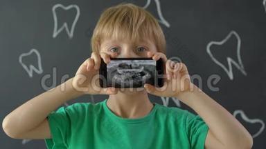 一个奶牙<strong>缺失</strong>的小男孩的特写镜头显示了他的x光牙齿图片。 儿童换牙的概念